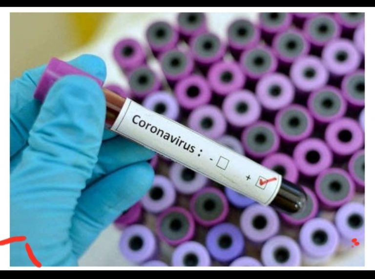 WhatsApp Image 2020-08-24 at 10.55.56 AM